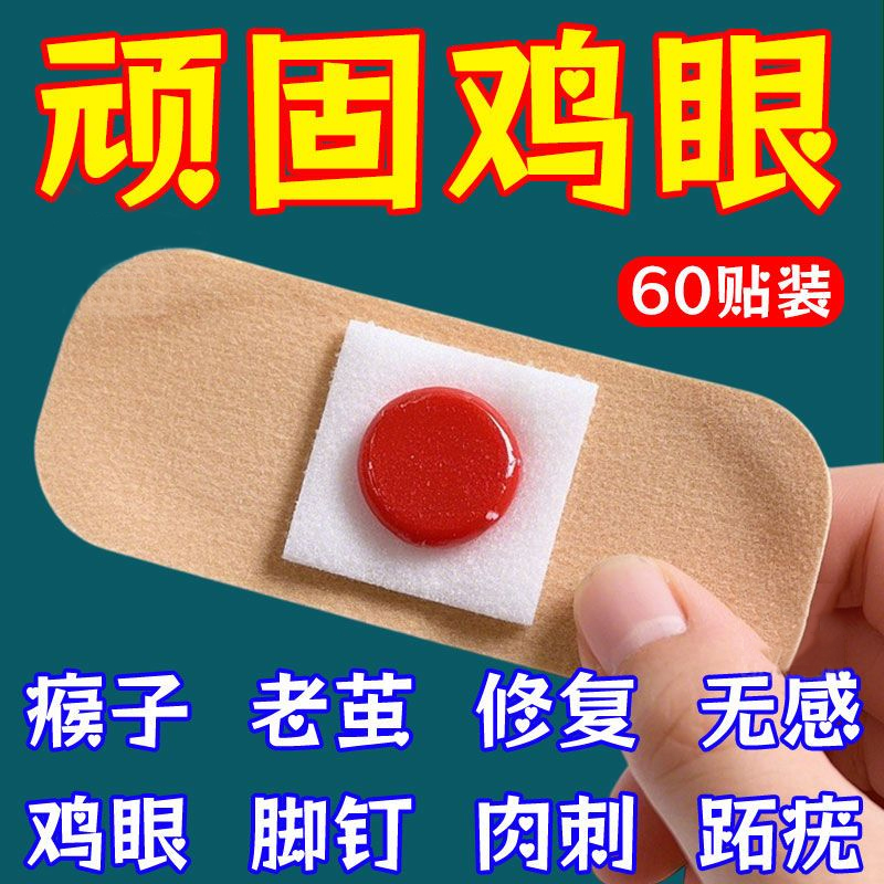 鸡眼贴鸡眼膏老茧肉刺手脚
