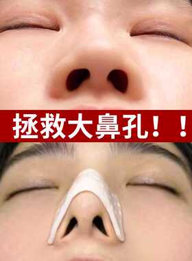 自捏塑形鼻夹板隆鼻子术后矫正固定器热塑鼻夹鼻子变挺防抠鼻神器