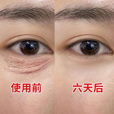 【屈臣氐推荐】再见眼角纹 淡化黑眼圈 收缩眼袋提拉眼部男女通用