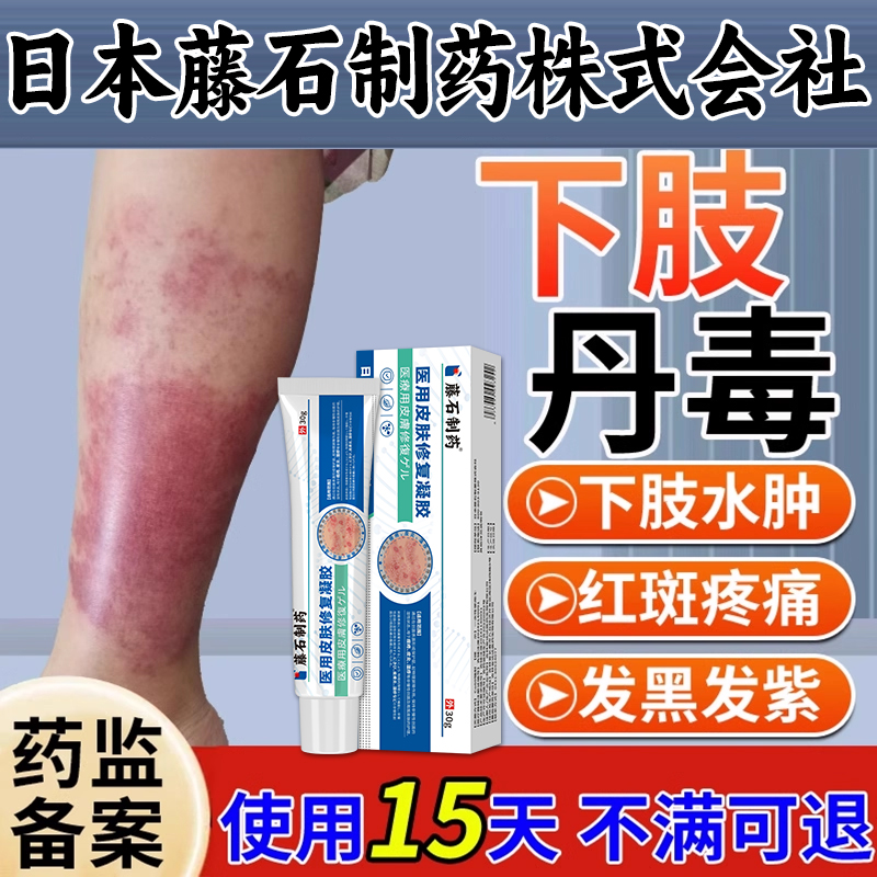 【医用级】下肢丹毒发黑发紫