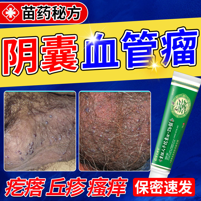 阴囊血管角化瘤血管痣红斑潮湿瘙痒丘疹蜘蛛痣表皮粗糙按压疼痛oa