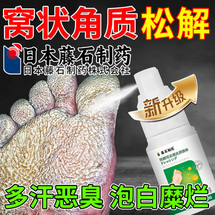 窝状角质松解懈症专用真菌感染水泡出汗臭脚气底蜂窝状沙虫喷剂xu