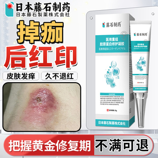 掉痂后红印修复摔伤擦伤疤痕祛抚平疤痕膏淡化色素沉淀药房同售xu