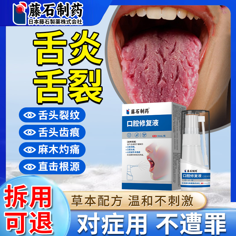 舌炎喷雾舌立康舌头裂缝溃疡纹有齿痕地图调理舌苔白厚漱口水xu