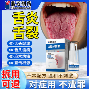 舌炎喷雾舌立康舌头裂缝溃疡纹有齿痕地图调理舌苔白厚漱口水xu
