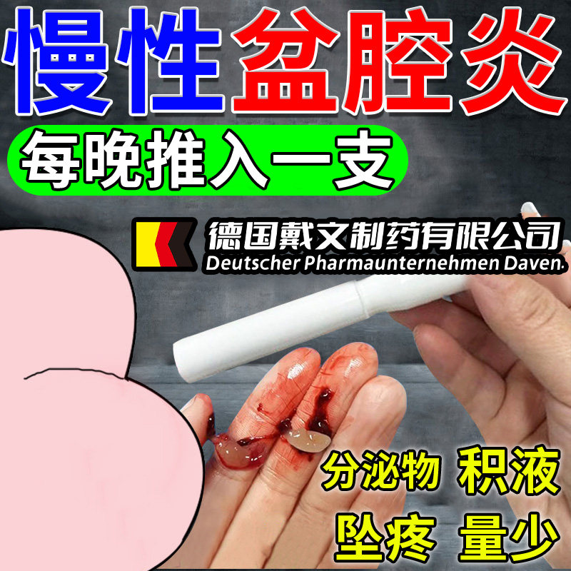 德国慢性盆腔炎栓剂热敷包疗盆腔积液中药贴消妇科炎症调理偏方OA