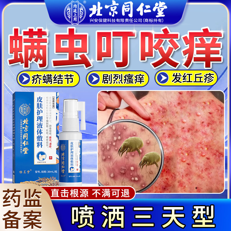 螨虫止痒治被毒虫叮咬特痒效除螨性皮炎祛痘无激素可搭膏药喷剂vb