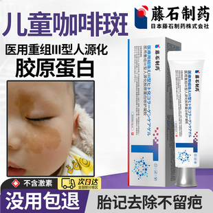 咖啡斑胎记去除儿童胎记牛奶斑神经性纤维瘤医用重组胶原蛋白贴xu