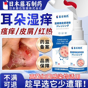 外耳道炎湿疹耳朵痒真菌感染止痒去真菌性根喷雾剂药房同售xu