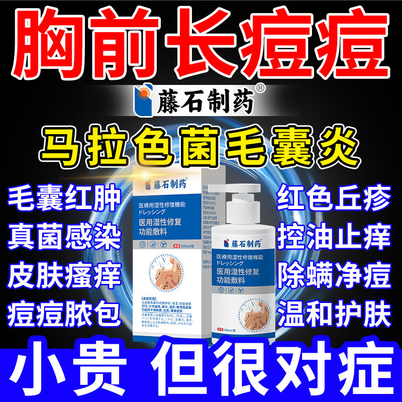 藤石制药前胸后背毛囊炎沐浴露胸前长痘背上马拉色菌除螨祛痘痒xu,保健用品,皮肤消毒护理（消）,淘宝优惠券,粉丝福利购,淘宝优惠卷