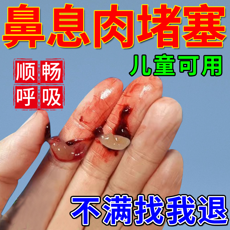 【医用级】鼻炎鼻息肉无痛脱落