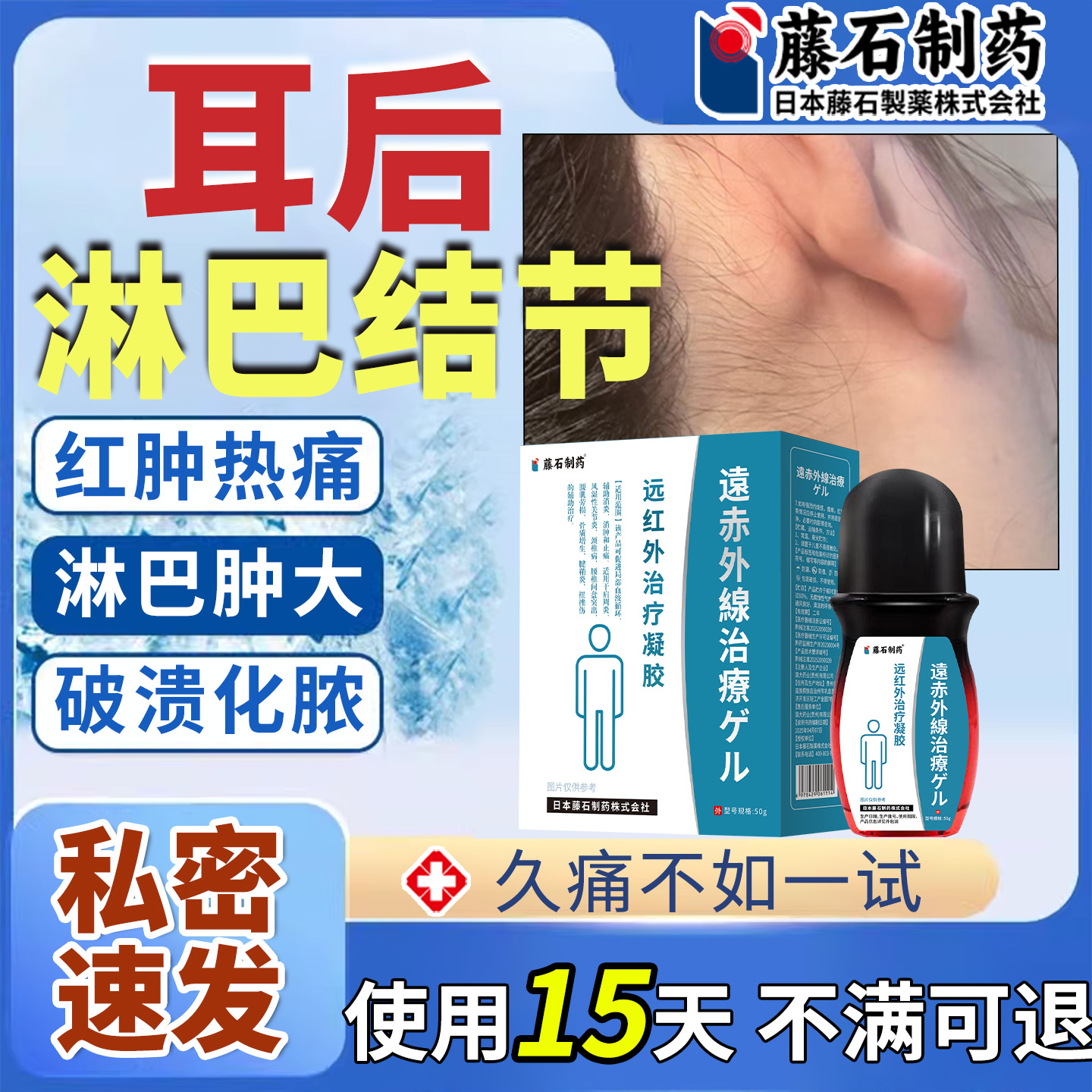 耳后淋巴结节肿大消散结膏耳朵后面长疙瘩鼓包囊肿除疏通走珠xu