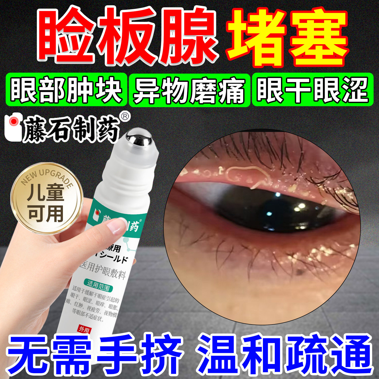 睑板腺堵塞专用医用滚珠疏通器干眼症眼睛异物可搭热敷治疗眼罩xu