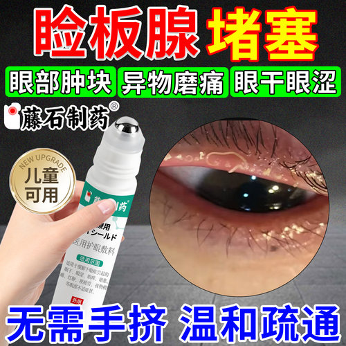 睑板腺堵塞专用医用滚珠疏通器干眼症眼睛异物可搭热敷治疗眼罩xu