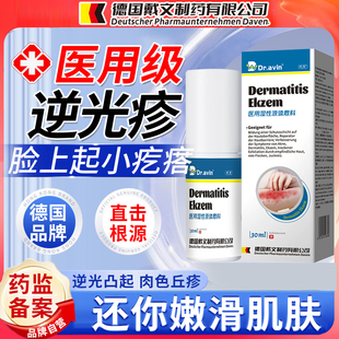 德国品牌逆光疹修复屏障脸上额头起小疙瘩闭口粉刺疹药监备案OA