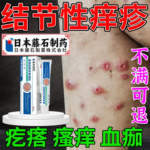 【医用级】胳膊腿上皮肤湿疹瘙痒