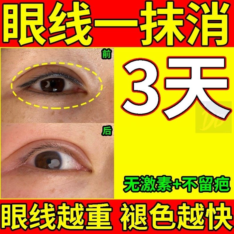 洗眼线褪色剂去纹身快速淡化纹眉半永美瞳线久纹印清洗不留疤神器