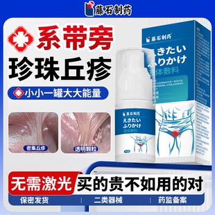 男性冠状沟系带旁珍珠疹粒状丘疹阴茎小疙瘩专去除用药膏喷雾LJ