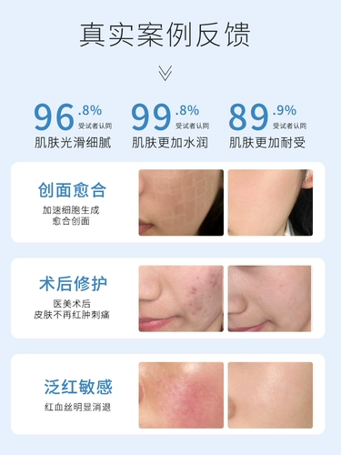 Alibaba Health Самостоятельная медицинская маска для лица с холодным компрессом, медицинский косметический ремонт и увлажнение, аутентичный официальный флагманский магазин