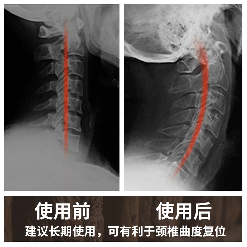 实木木头枕头颈椎修复专用治疗枕病人硬护颈椎助睡眠圆枕头矫正器