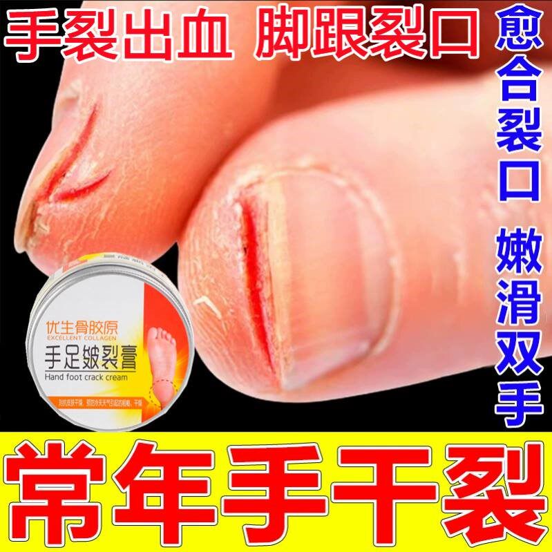 治手裂的药膏防干裂专治手指开裂皲裂脚后跟裂口手脱皮专用修复霜