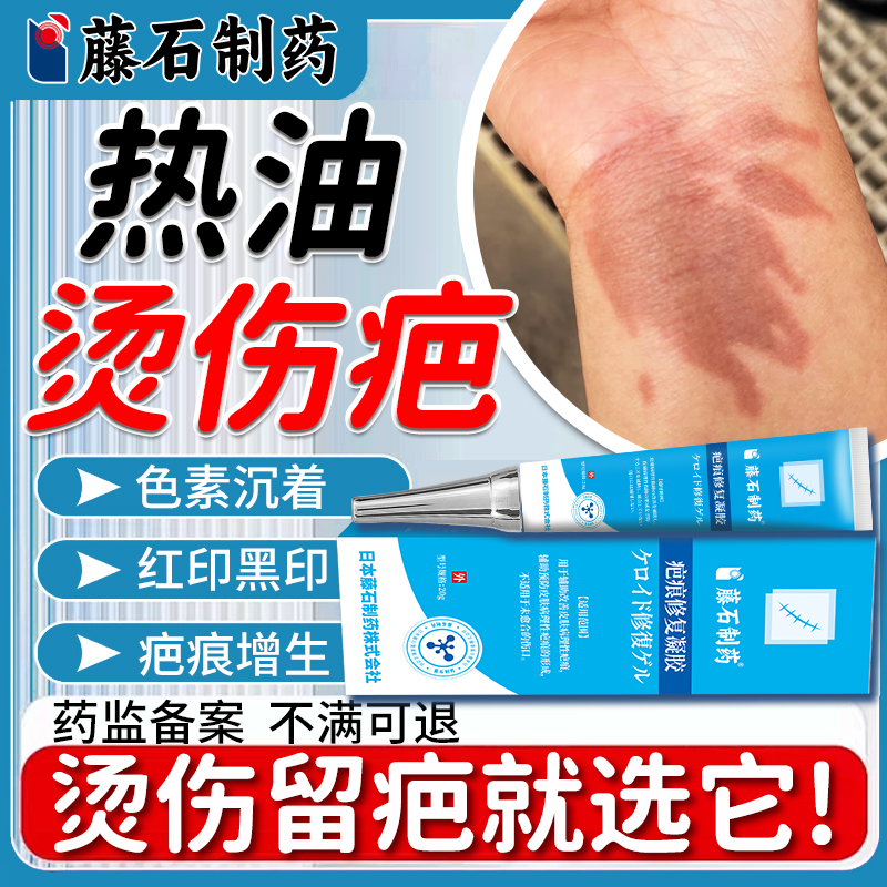 热油烫伤疤痕除疤膏修复祛去黑印色素沉淀儿童增生凸起疙瘩去除XY