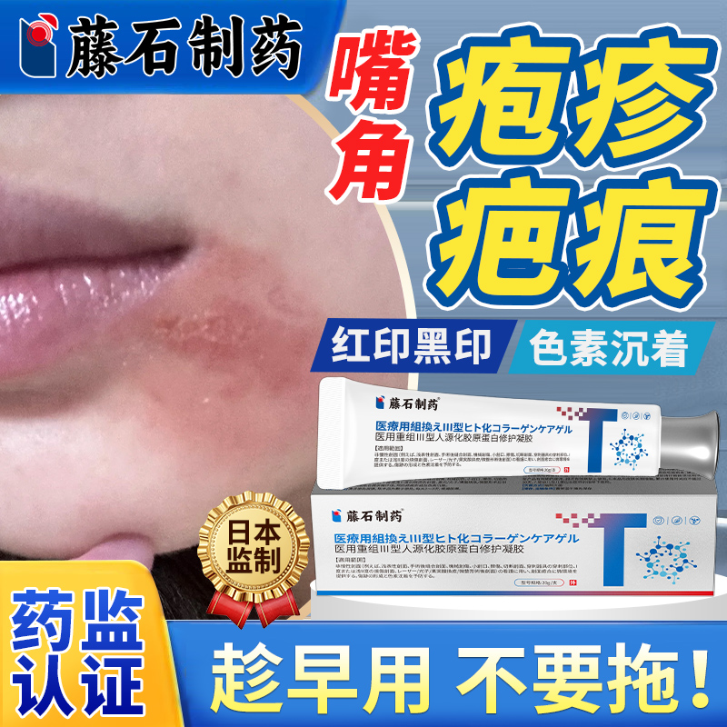 嘴唇疱疹结痂掉后留疤印专用