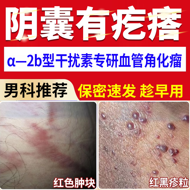 阴囊血管瘤角化瘤黑红疙瘩蜘蛛痣红斑红肿按压疼痛湿疹静脉曲张jh