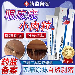 眼皮疣眼皮上长小肉粒肉球丝状疣扁平疣面颈部专用膏医用祛疣瘊XG