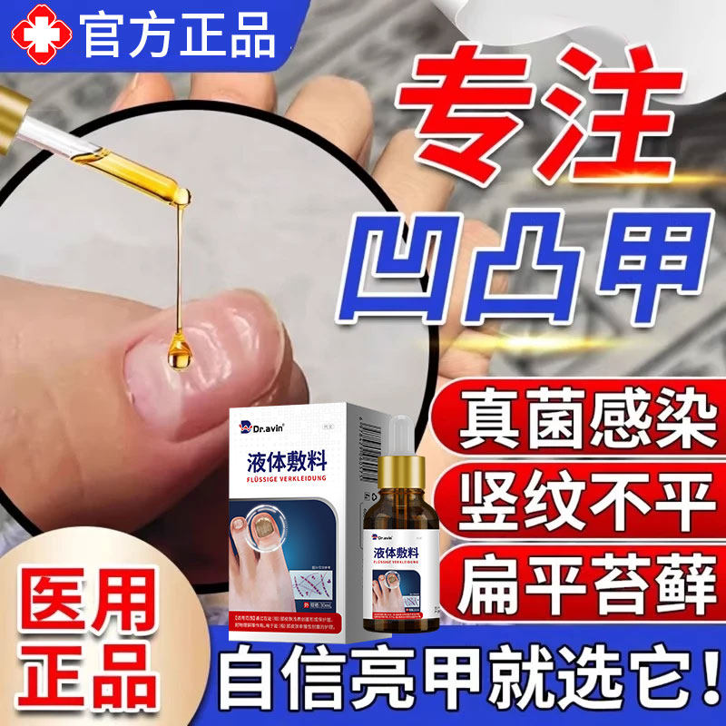 指甲凹凸不平修复液竖纹调理受损再生养甲床甲肉分离真菌感染YZ