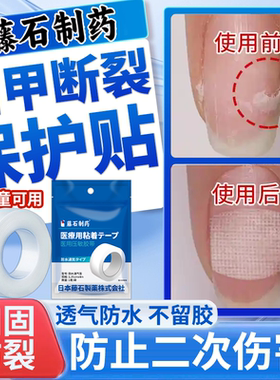 指甲保护贴防手指甲边缘开裂断裂劈了断甲修复保护套医用级儿童VQ