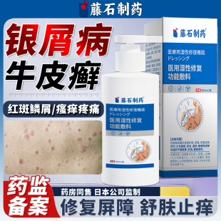 牛皮癣银屑病沐浴露专用洗发水头癣头皮癣真菌感染药房同售软膏HT