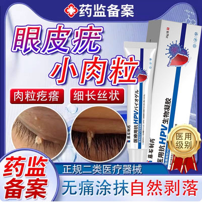眼皮疣眼皮长小肉粒专用