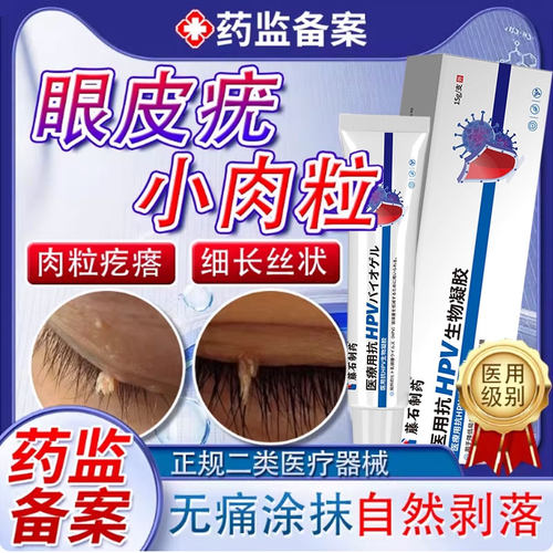 眼皮疣眼皮长小肉粒专用