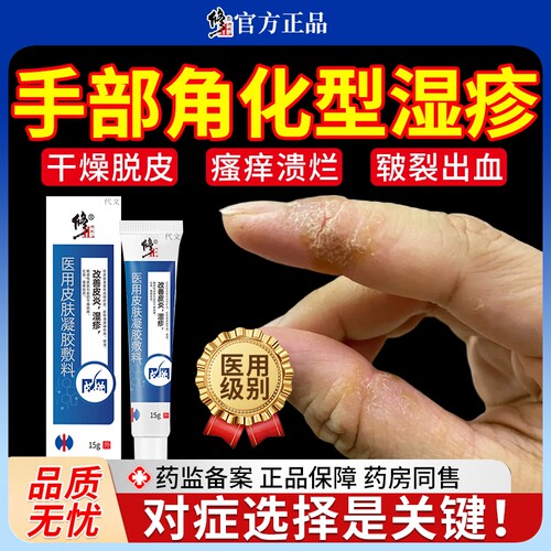 手部-角化型湿疹-干燥皲裂脱皮