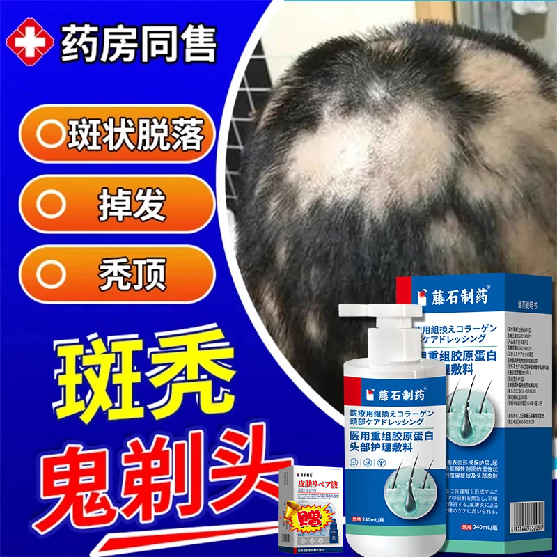 鬼剃头斑秃洗发膏