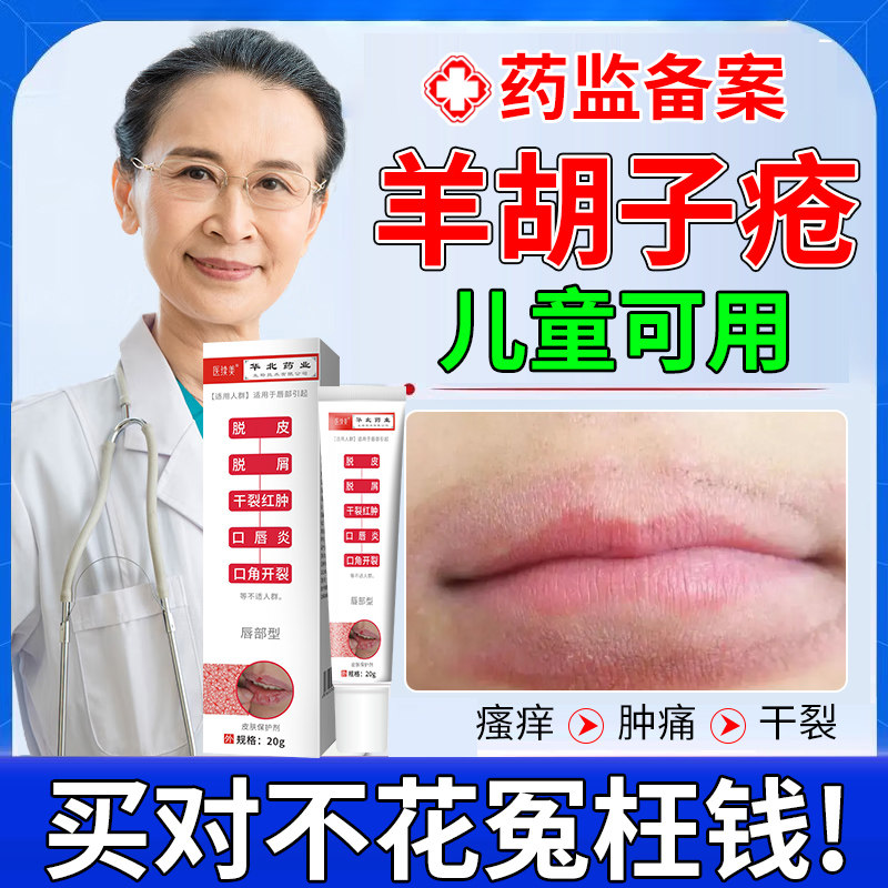 儿童羊胡子疮舔嘴唇口周炎专用唇炎干裂疱疹须疮瘙痒可搭药膏用aa