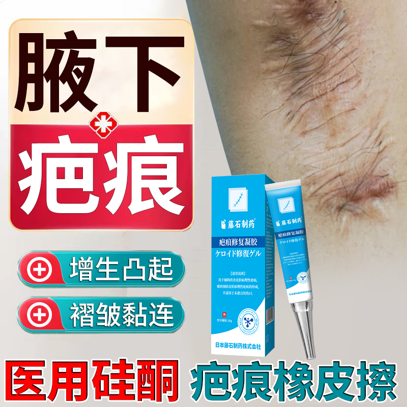 藤石制药腋下疤痕挛缩增生