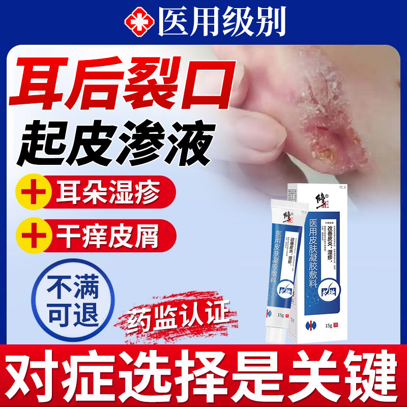 耳后外耳道湿疹耳朵后痒烂起皮耳根裂口开裂真菌感染药房同款膏HT,医疗器械,保健理疗,淘宝优惠券,粉丝福利购,淘宝优惠卷
