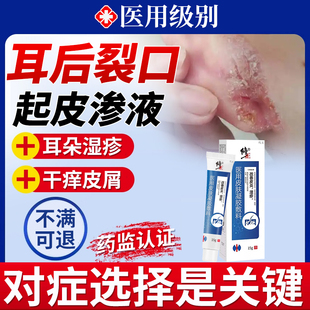 耳后外耳道湿疹耳朵后痒烂起皮耳根裂口开裂真菌感染药房同款膏HT