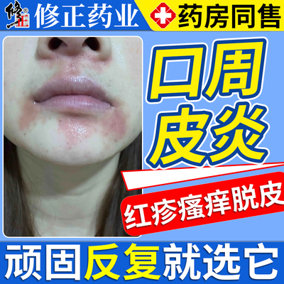口周皮炎专用嘴角干燥起皮