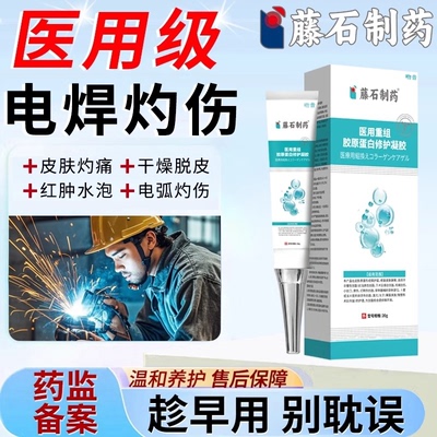 电焊工脸灼伤发红干燥脱皮烫伤膏