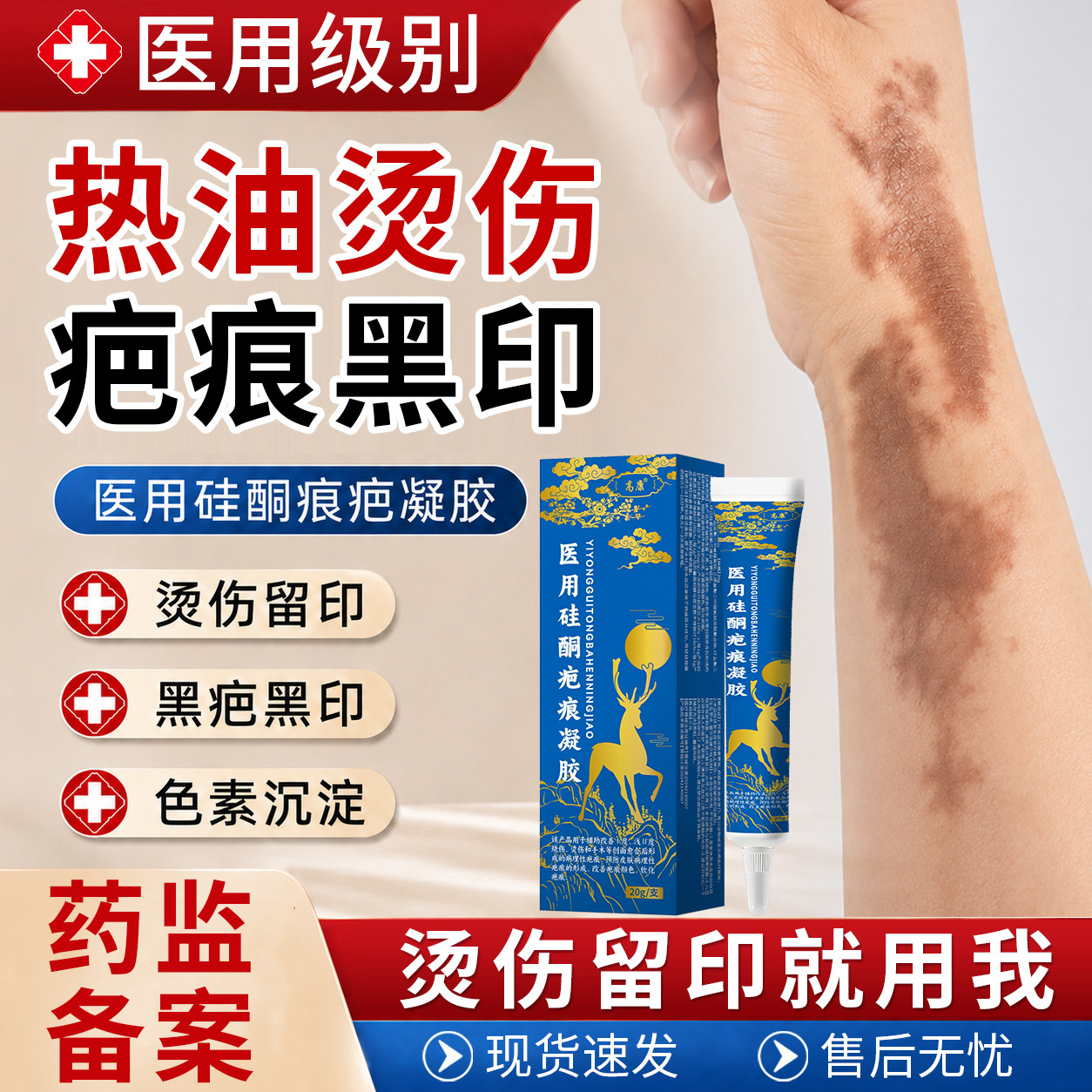 热油烫伤黑印去黑色素沉淀印祛去疤膏疤痕修复除疤烧伤医用级WQ