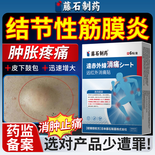 肌肉结节性筋膜炎硬块专用皮下鼓包肿块散结消肿药房同售膏药贴HT