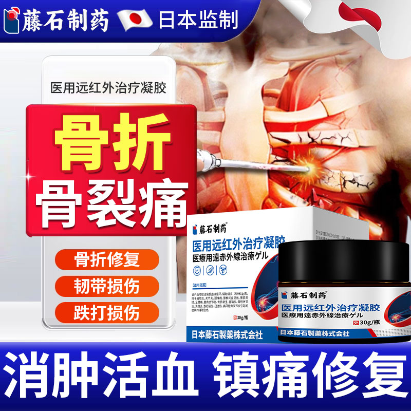藤石远红外治疗凝胶骨折骨裂恢复