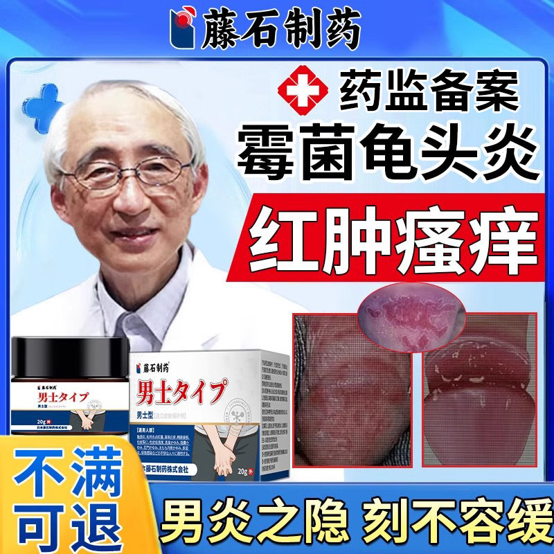 男性龟头炎真菌感染霉菌性型炎症专用念珠菌红斑白垢可搭配药膏vq