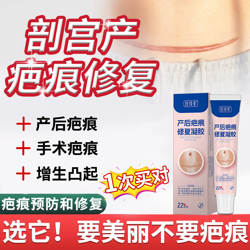 剖腹产疤痕医用硅酮凝胶修护贴专用剖宫产刨腹妇产去疤膏WQ