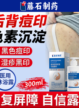 后背痘印黑色素沉淀去除淡化疤痕修复去祛黑印湿疹医用护理敷料WQ