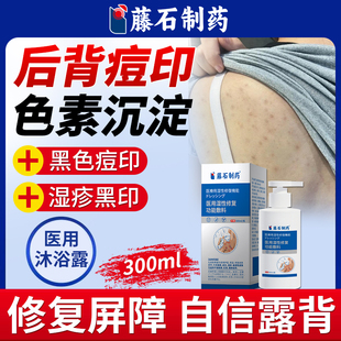 后背痘印黑色素沉淀去除淡化疤痕修复去祛黑印湿疹医用护理敷料WQ