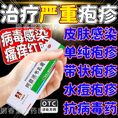 阿昔洛韦乳膏正品带状疱疹后遗症神经痛用药断病根外用膏特药效WJ